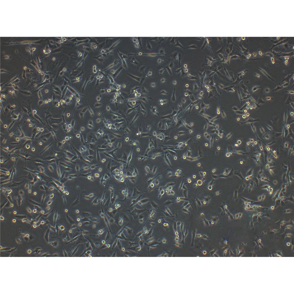 MeWo Cells人恶性黑色素瘤细胞系(提供STR图谱)