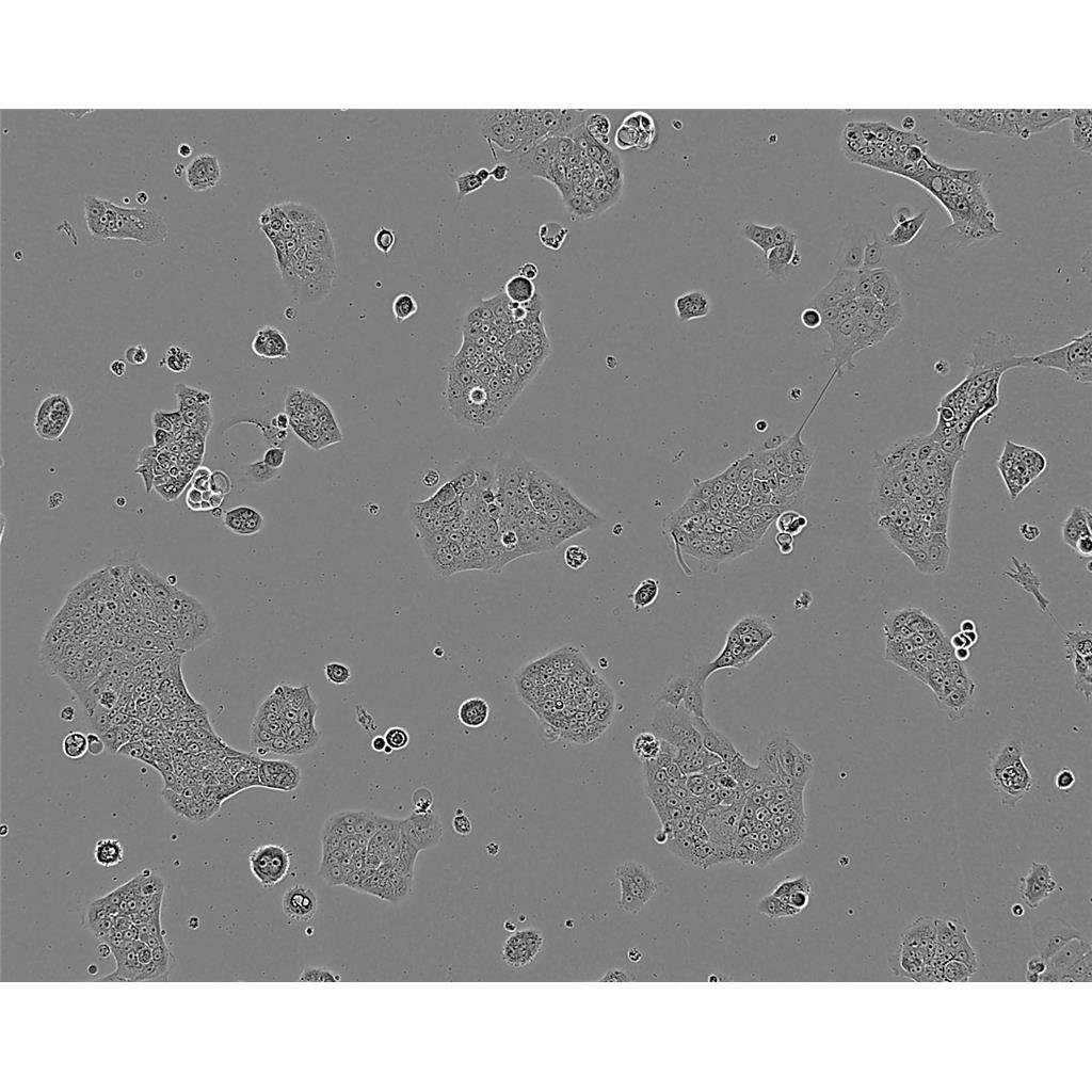 12Z Cells人子宫内膜异位上皮细胞永生化细胞系(提供STR图谱)