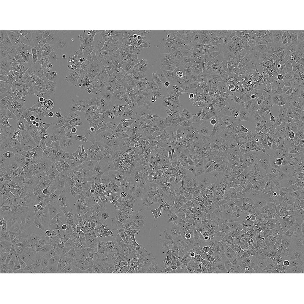 SRA01/04 Cells永生化人晶状体上皮细胞系(提供STR图谱)