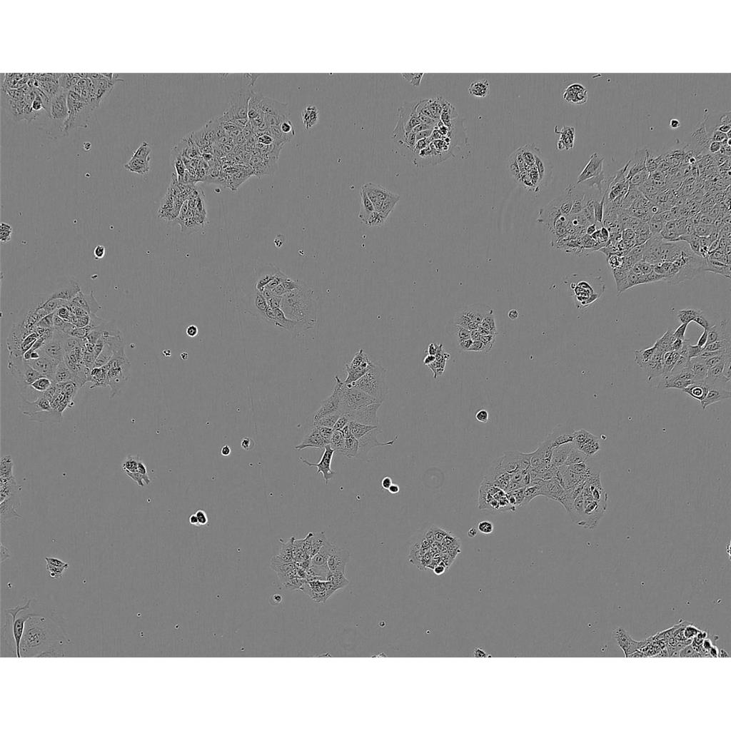 GCT Cells人巨细胞瘤细胞系(提供STR图谱)