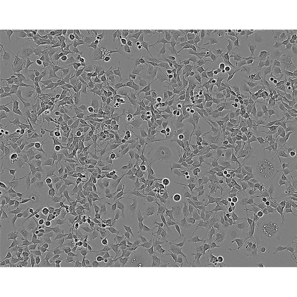 NCI-H187 Cells人小细胞肺癌细胞系(提供STR图谱)