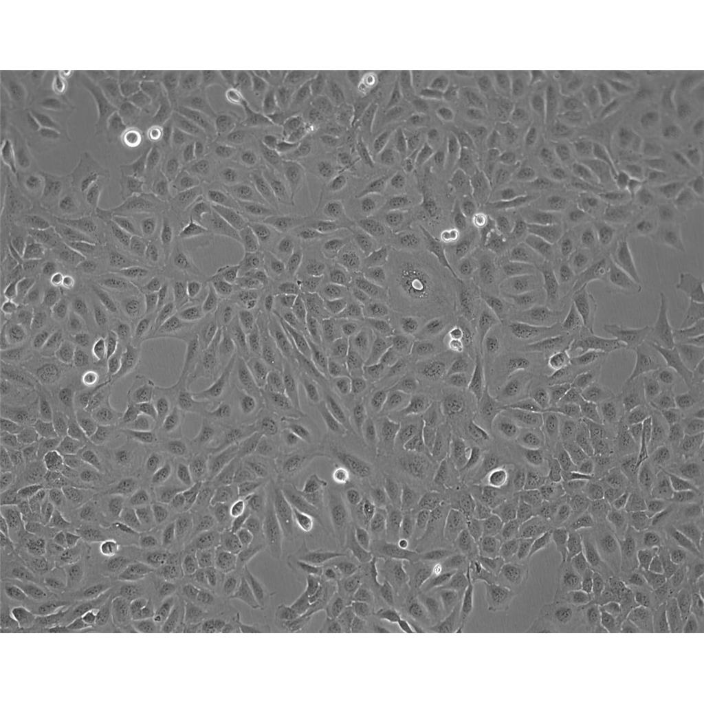 Y3-Ag 1.2.3 Cells大鼠骨髓瘤细胞系(提供STR图谱)