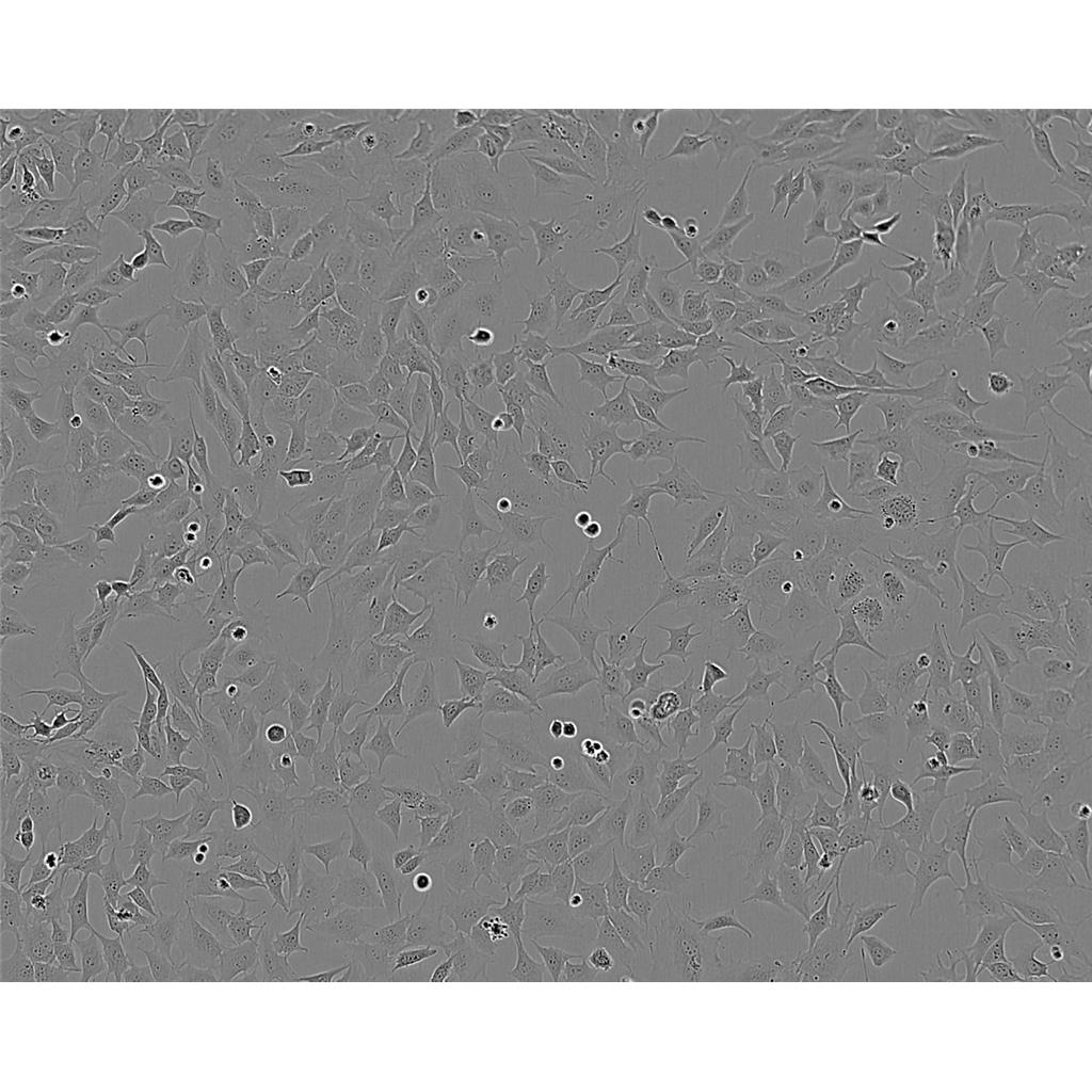 L5178Y TK+/- clone<3.7.2C> Cells小鼠淋巴瘤细胞系(提供STR图谱)