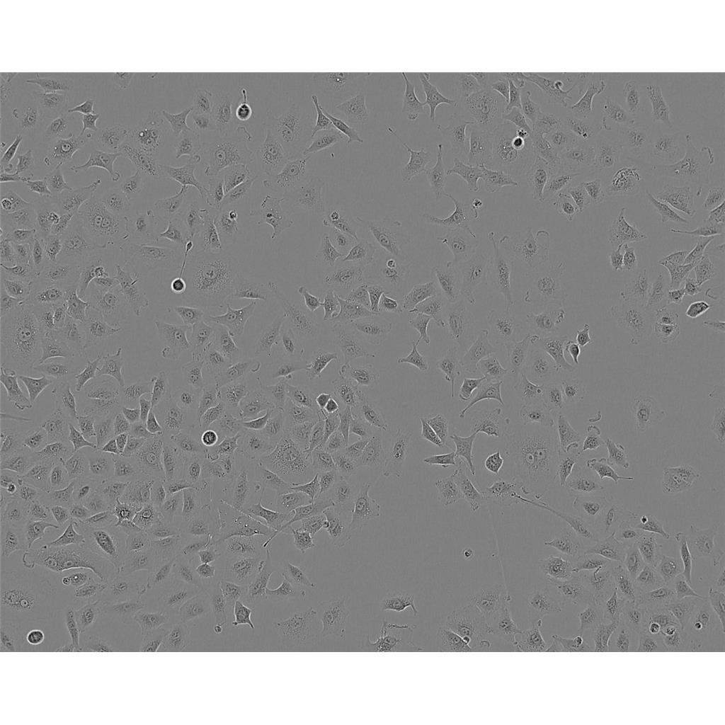 NCI-H508 Cells人结肠直肠腺癌细胞系(提供STR图谱)