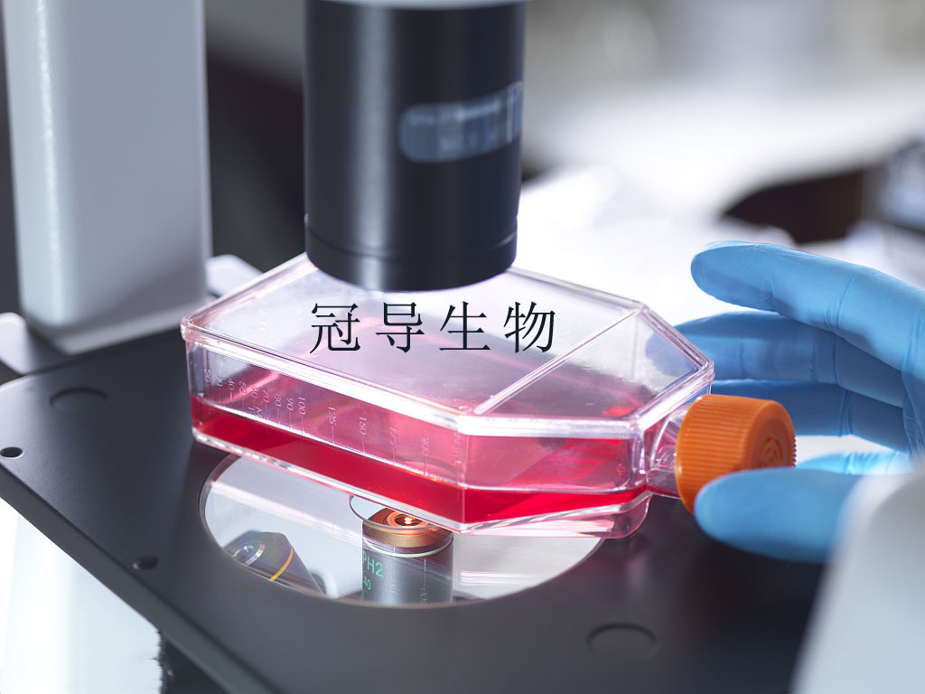 mda-MB 468 Cells人乳腺癌细胞系(提供STR图谱)