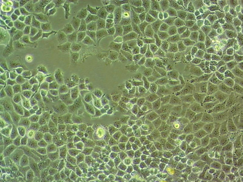 U-251MG Cells人神经胶质瘤细胞系(提供STR图谱)