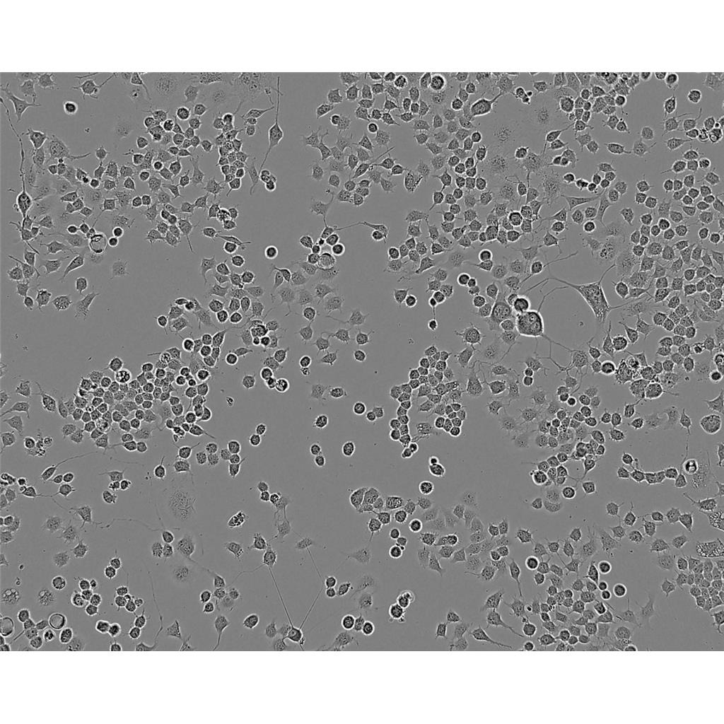 BT-B Cells人膀胱癌细胞系(提供STR图谱)