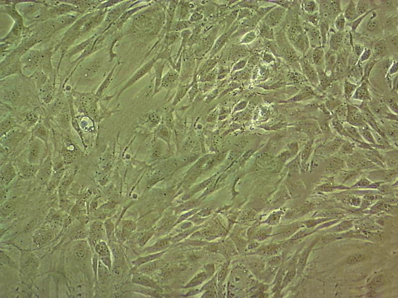 hFOB 1.19 Cells人SV40转染成骨细胞系(提供STR图谱)