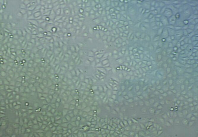 SW-579 Cells人甲状腺鳞癌细胞系(提供STR图谱)