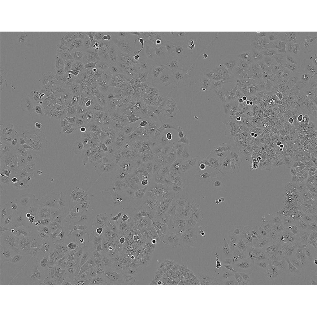 MT4 Cells人急性淋巴母细胞白血病细胞系(提供STR图谱)