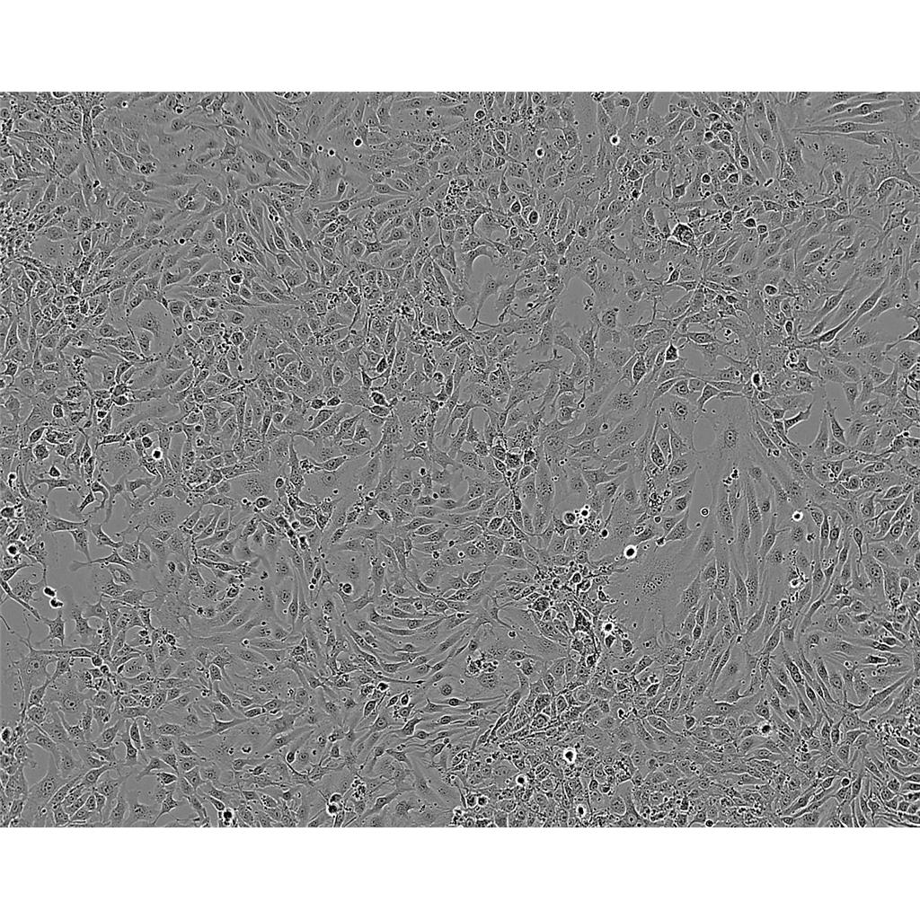 PC3 Cells人前列腺癌细胞系(提供STR图谱)