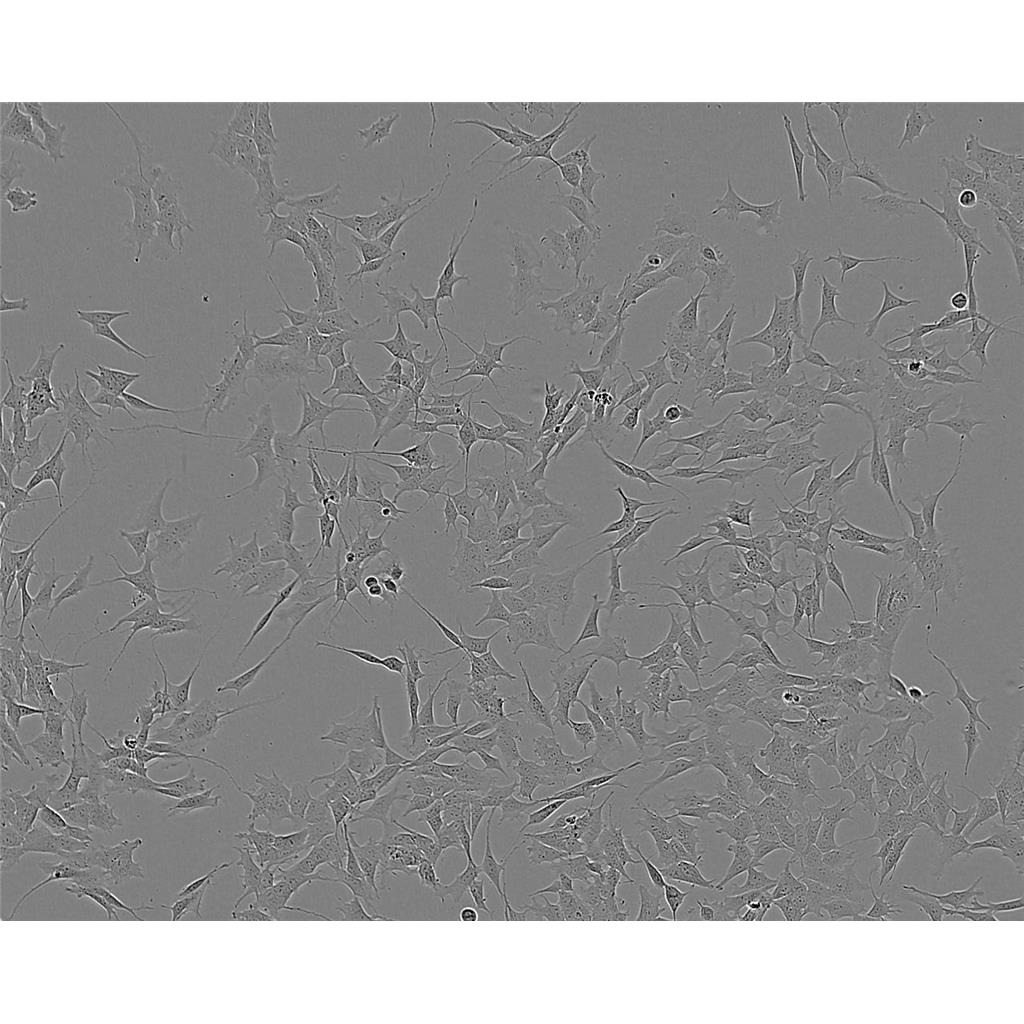 GES1 Cells人胃黏膜上皮细胞系(提供STR图谱)