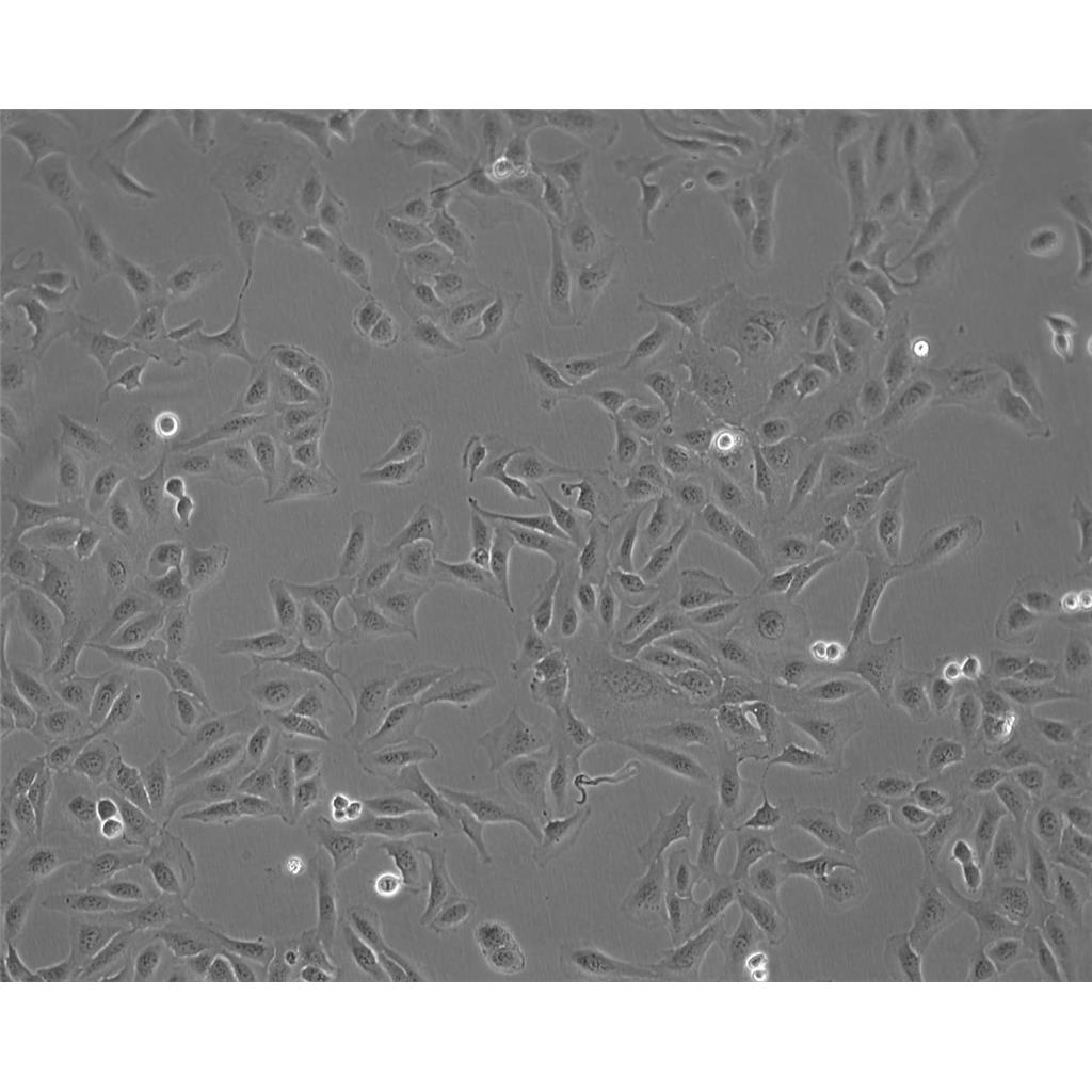 C33A Cells人子宫颈癌细胞系(提供STR图谱)