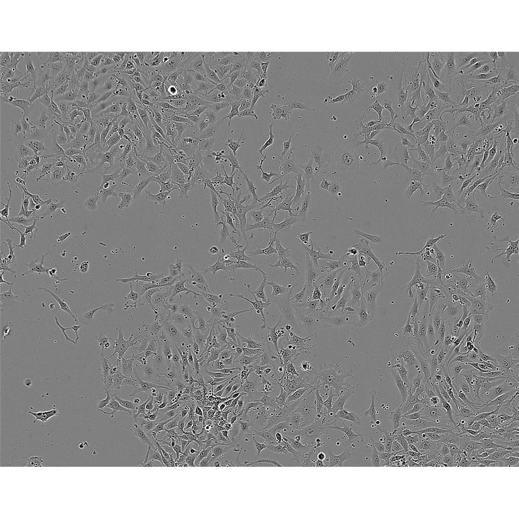 SKN-AS Cells人脑神经母细胞瘤细胞系(提供STR图谱)