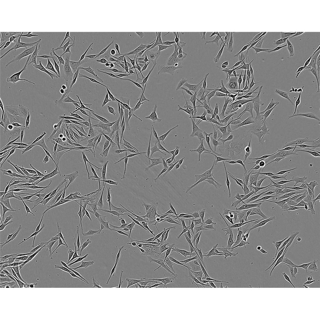 mda MB 175 VII Cells人乳腺导管癌细胞系(提供STR图谱)