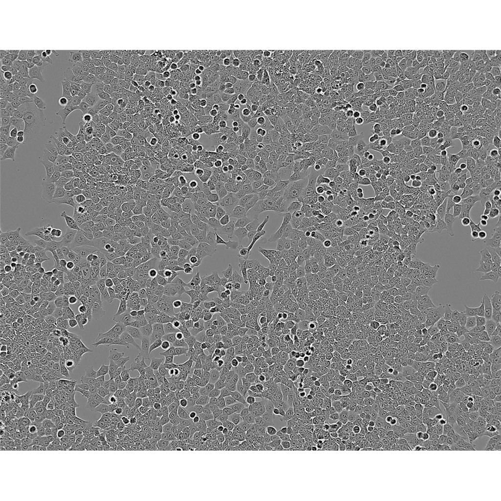 CCRF-CEM C1 Cells人急性淋巴细胞白血病细胞系(提供STR图谱)