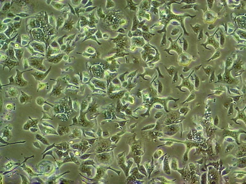 Eca109 Cells人食管癌细胞系(提供STR图谱)