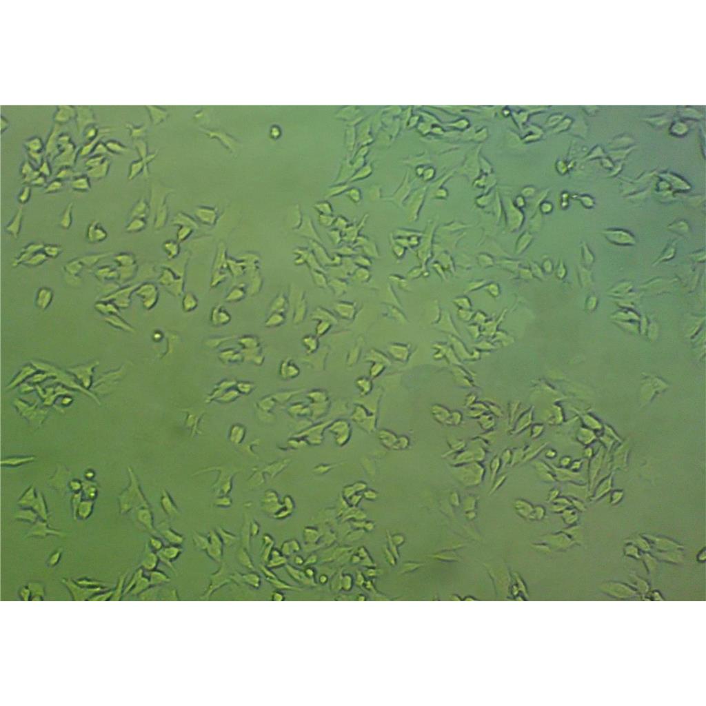 SW-1353 Cells人软骨肉瘤细胞系(提供STR图谱)