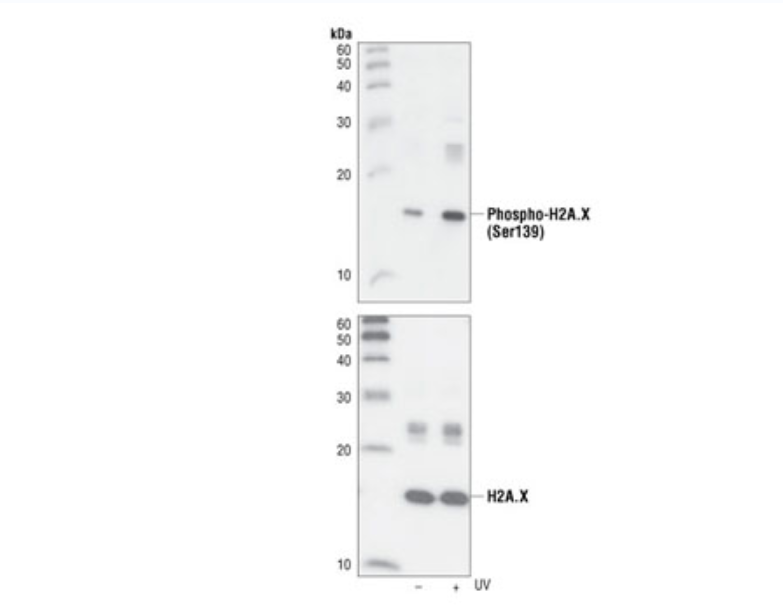 磷酸化组蛋白H2A.X（Ser139）（20E3）兔单克隆抗体