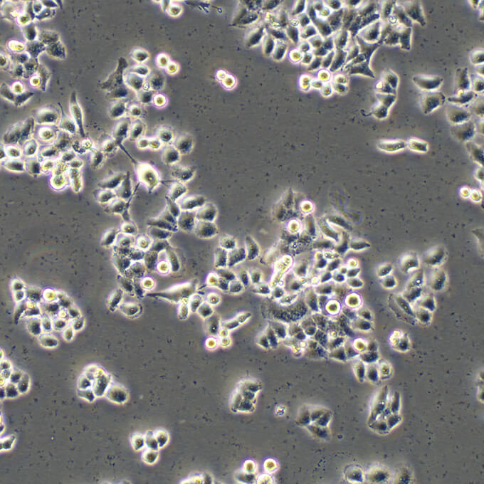 22RV1 Cells人前列腺癌复苏细胞系(有STR鉴定图谱)