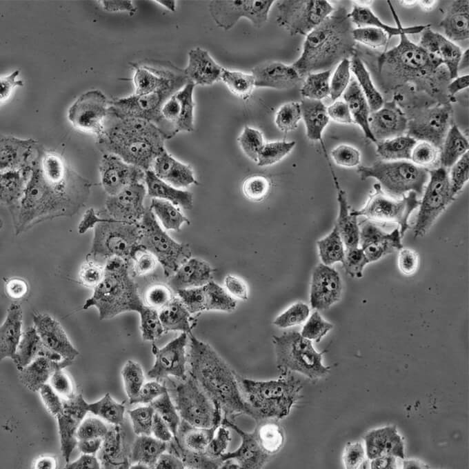 BT-549 Cells人乳腺管癌复苏细胞系(有STR鉴定图谱)