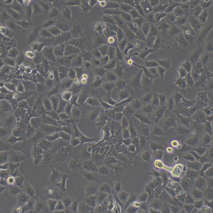 Calu-3 Cells人肺腺癌复苏细胞系<胸水>(有STR鉴定图谱)