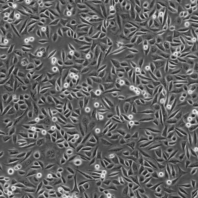 CCRF-CEM[CCRF CEM] Cells人急性淋巴细胞白血病T淋巴复苏细胞系(有STR鉴定图谱)