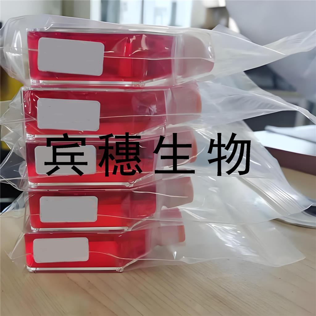 Hep G2 Cells人肝癌复苏细胞系(有STR鉴定图谱)