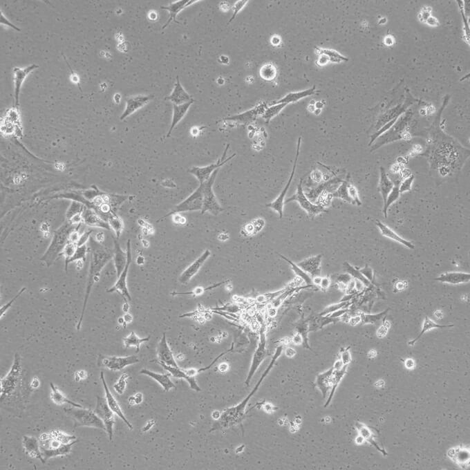 HEC-1-B Cells人子宫内膜腺癌复苏细胞系(有STR鉴定图谱)