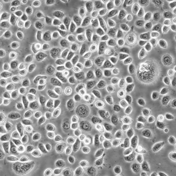 Hela Cells人宫颈癌复苏细胞系(有STR鉴定图谱)