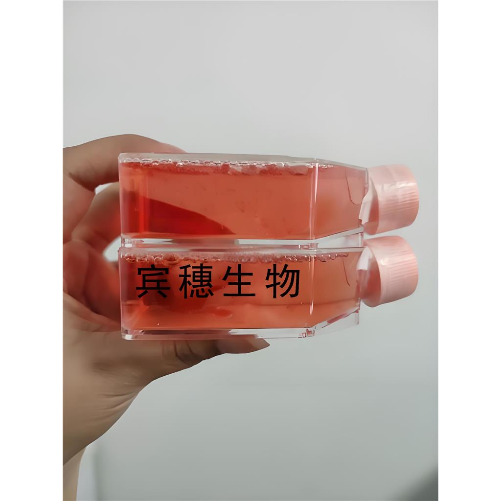 LS 174T[LS174T] Cells人结肠腺癌复苏细胞系(有STR鉴定图谱)