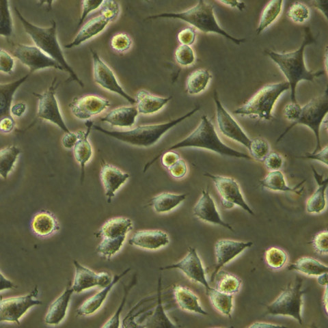 OS-RC-2 Cells人肾癌复苏细胞系(有STR鉴定图谱)