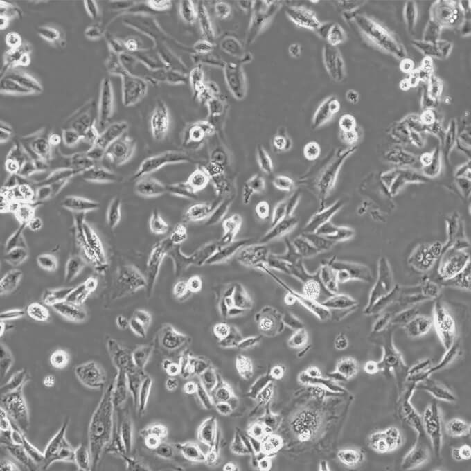 Saos-2 Cells人成骨肉瘤复苏细胞系(有STR鉴定图谱)