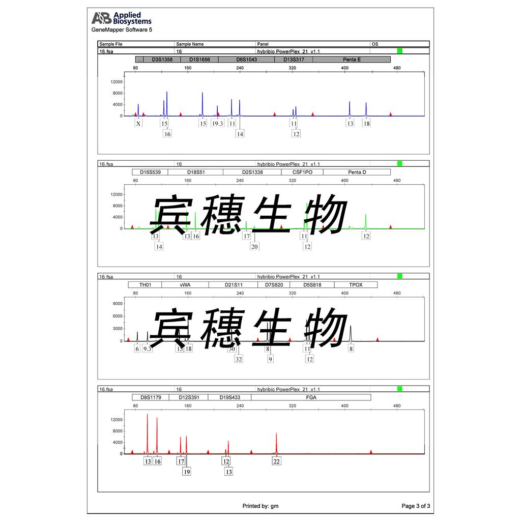 HuTu-80 Cells人十二脂肠腺癌复苏细胞系(有STR鉴定图谱)