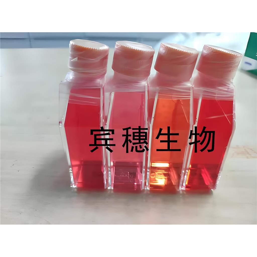 HuTu-80 Cells人十二脂肠腺癌复苏细胞系(有STR鉴定图谱)