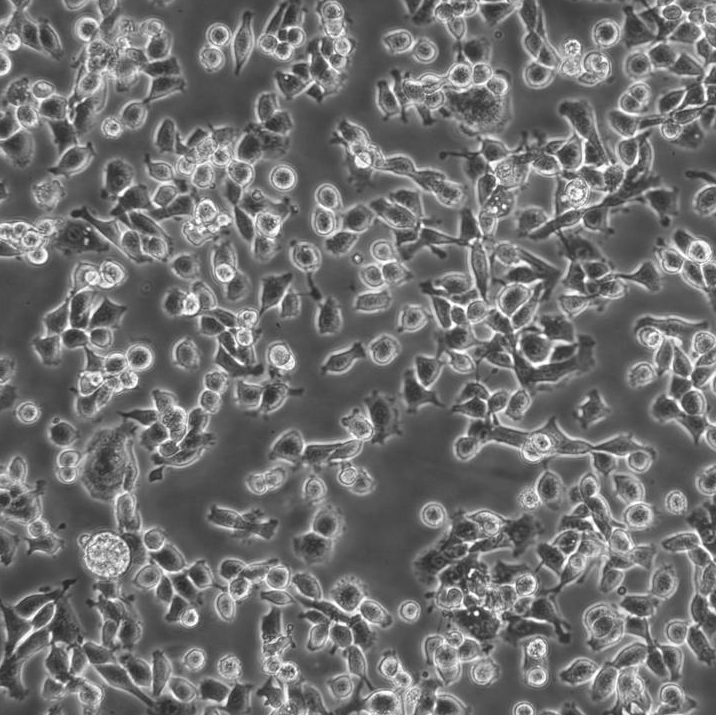 HPAC Cells人胰腺腺泡上皮癌复苏细胞系(有STR鉴定图谱)