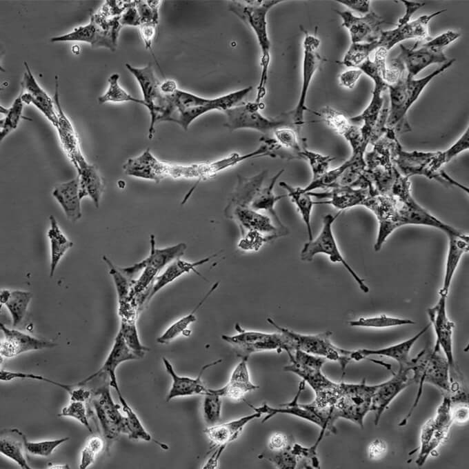 SK-MEL-1 Cells人皮肤黑色素瘤复苏细胞系(有STR鉴定图谱)