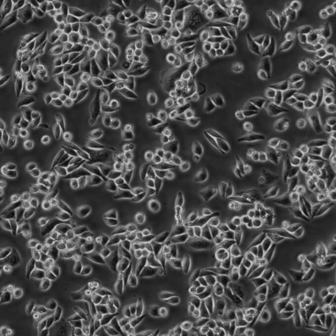 UM-UC-3 Cells人膀胱移行癌复苏细胞系(有STR鉴定图谱)