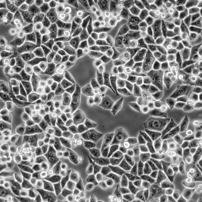 hFOB 1.19 Cells人SV40转染成骨复苏细胞系(有STR鉴定图谱)