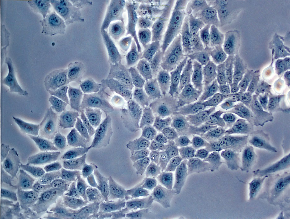 95-D[PLA-801D]人高转移肺癌细胞系保种库(附带STR基因图谱)