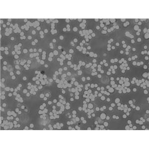 T2(174 x CEM.T2)人淋巴母细胞系保种库(附带STR基因图谱)