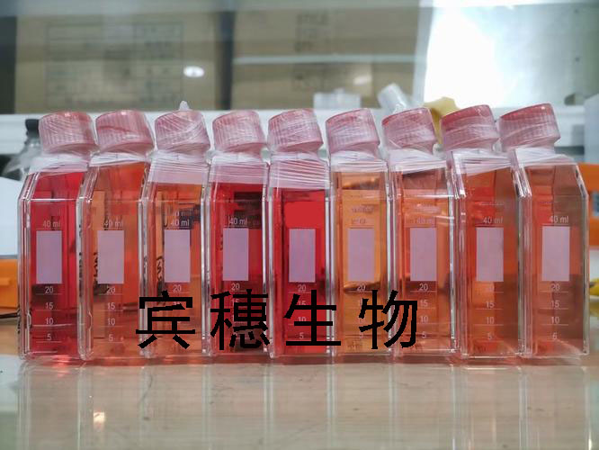 HCC70 Cells人乳腺导管癌贴壁细胞系(赠送STR基因图谱)