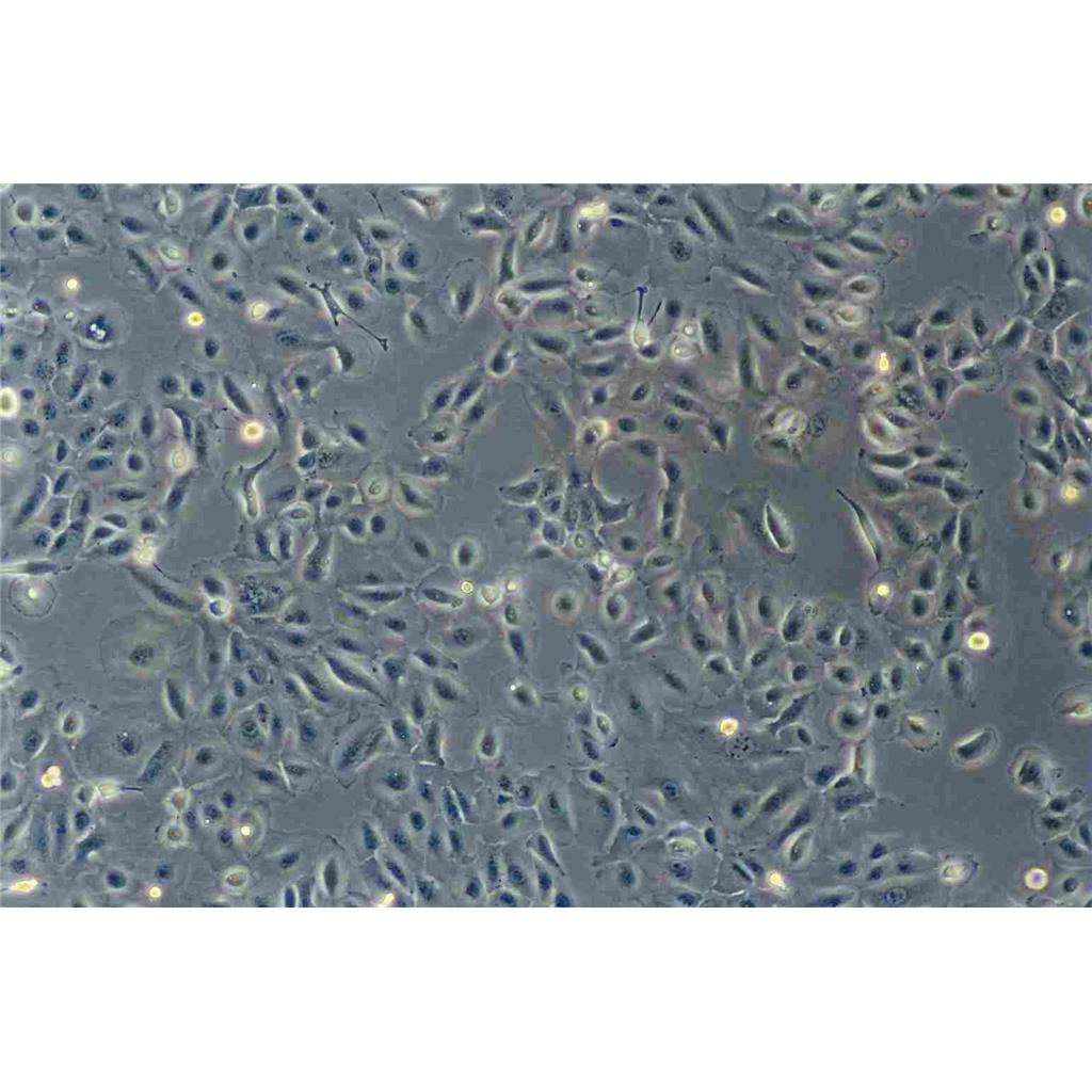 SK-MEL-1 Cells人皮肤黑色素瘤可传代细胞系(送STR鉴定图谱)