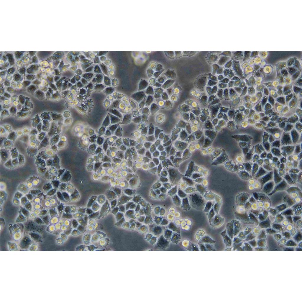 NCI-H358 Cells人非小细胞肺癌贴壁细胞系(赠送STR基因图谱)