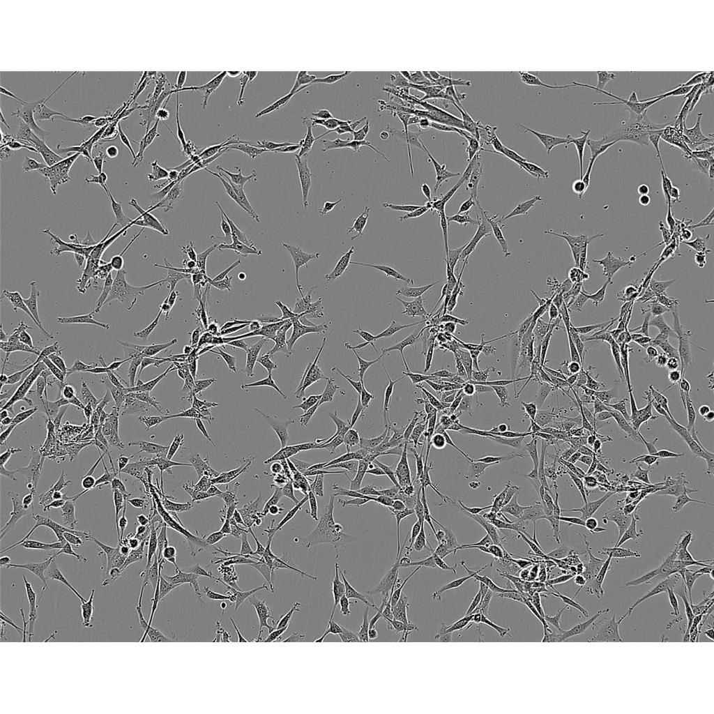 QGP-1 Cells人胰腺癌贴壁细胞系(赠送STR基因图谱)