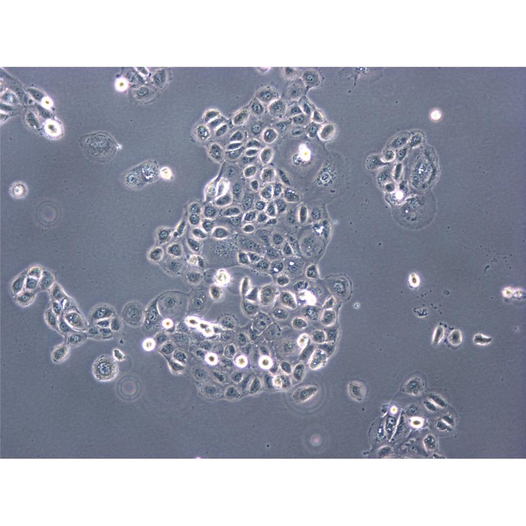 NCI-H187 Cells人小细胞肺癌贴壁细胞系(赠送STR基因图谱)