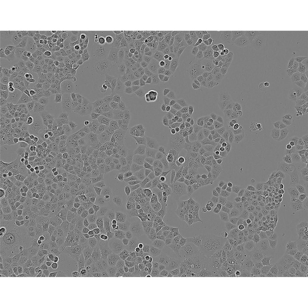 CAL-33 Cells人舌鳞癌贴壁细胞系(赠送STR基因图谱)