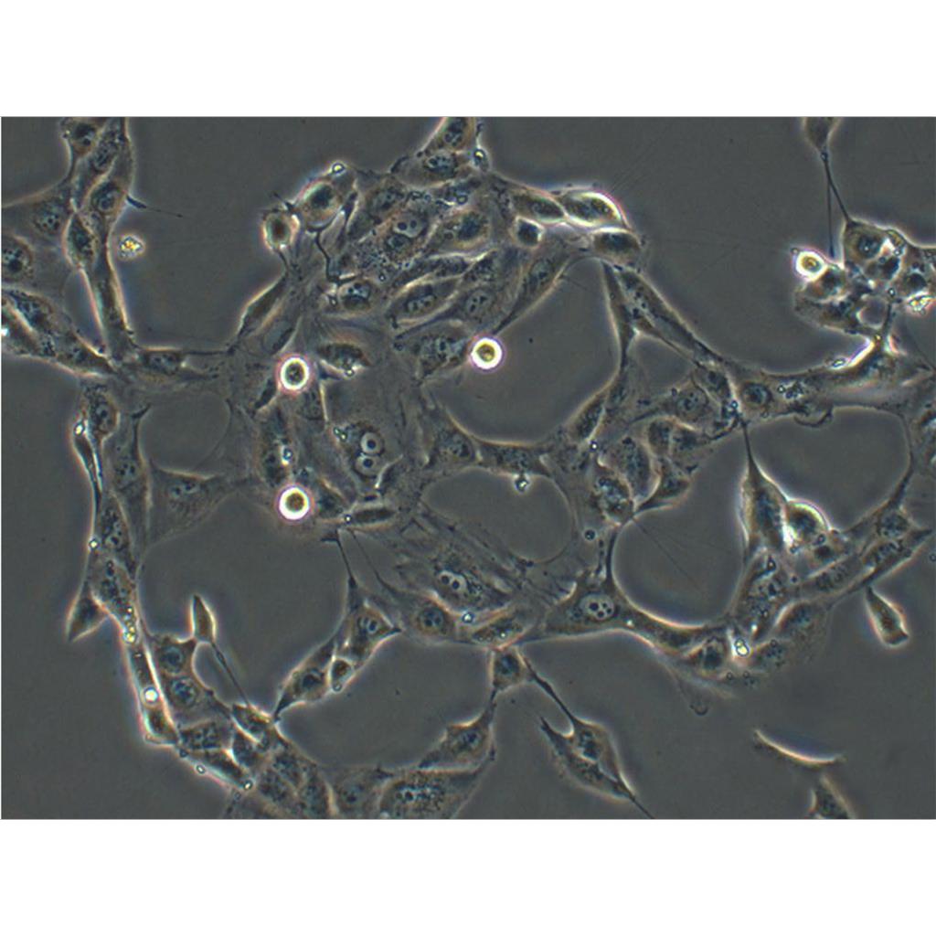 COLO-680N Cells人食管鳞状癌贴壁细胞系(赠送STR基因图谱)