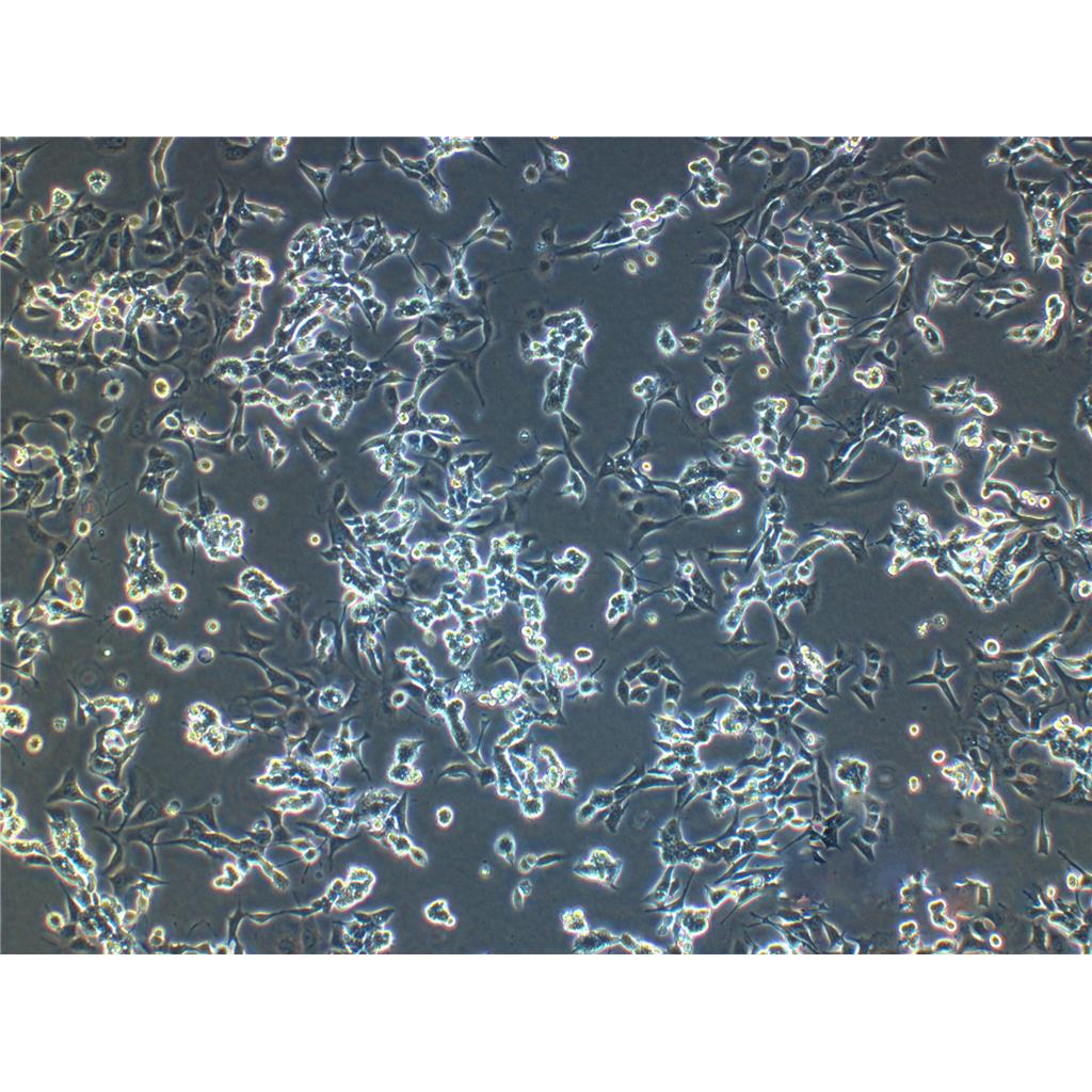 NCI-H1993 Cells人非小细胞肺癌腺癌贴壁细胞系(赠送STR基因图谱)