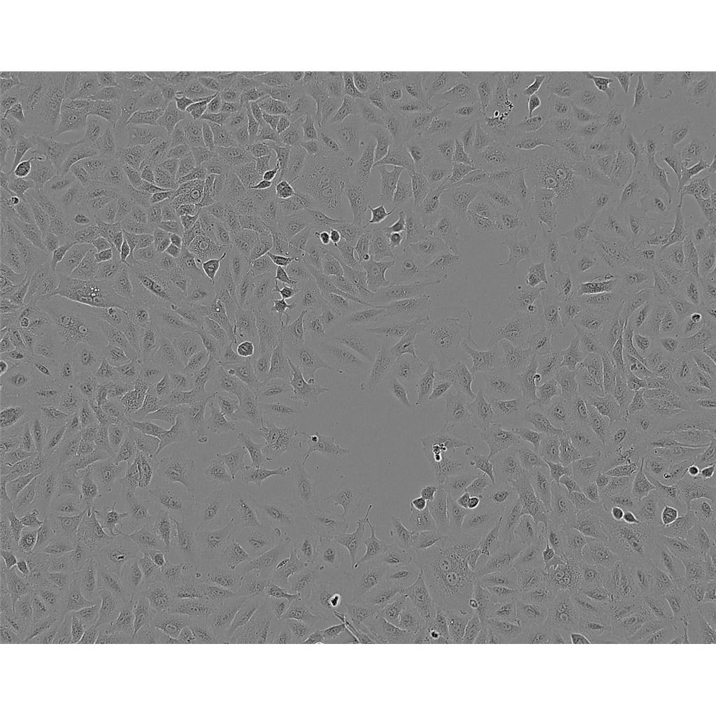 UM-SCC-1 Cells人口底鳞癌贴壁细胞系(赠送STR基因图谱)